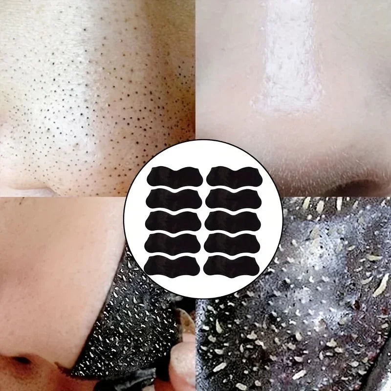 Blackhead removal tool being used on skin with blackheads.