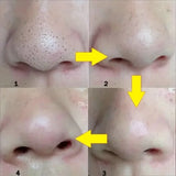 Collage of four images showing a close-up of a nose with yellow arrows pointing to different areas.